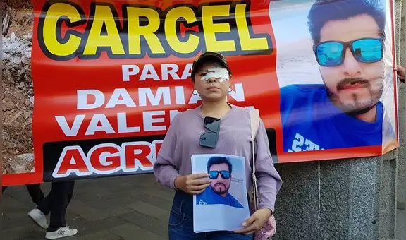 Modelo denuncia a hombre por causarle graves lesiones en el rostro con una botella en Arequipa