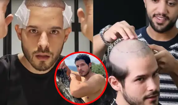 Andrés Vílchez se RAPA el pelo para una cirugía y deja a usuarios en SHOCK: "Ya no hay vuelta atrás"