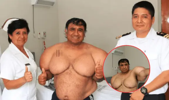 El extraño caso de Alejandro Ramos, el buzo peruano que lleva 11 años 'inflado' tras sufrir un accidente: su condición es única en el mundo