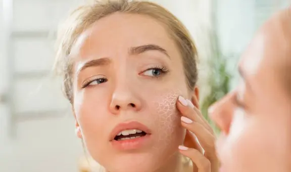 “Cara de cortisol”: la nueva tendencia viral que obsesiona a los usuarios de TikTok y preocupa a los médicos