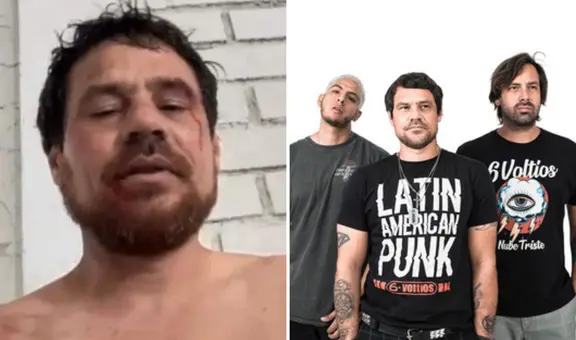 Alexis Korfiatis, de ‘6 Voltios’, sufre violento asalto: fue golpeado y le robaron el auto