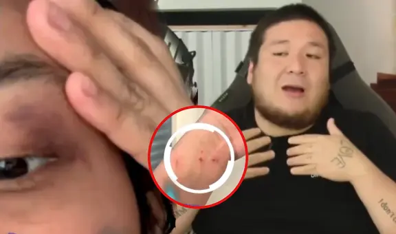 Streamer ‘Kingteka’ es acusado de agresión física por su expareja y muestra pruebas del maltrato