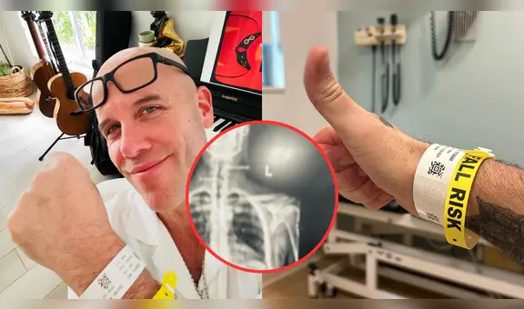 Gian Marco reaparece y revela detalles sobre su delicado estado de salud: "Me van a infiltrar la columna"