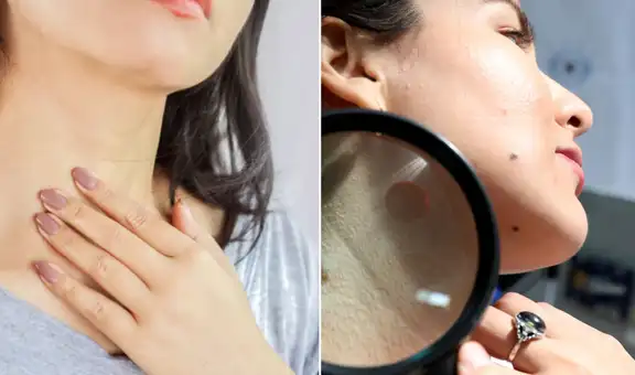 Líneas en el cuello: ¿es un signo de envejecimiento, mala salud o algo más? descúbrelo aquí