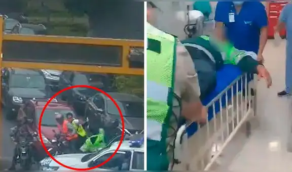 Policía gravemente herido en San Borja necesitará cirugía reconstructiva facial: estos son los detalles de su estado