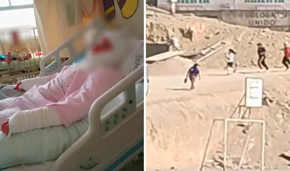 Profesor intenta prender antorcha por olimpiadas escolares en SJL y niña termina con graves quemaduras