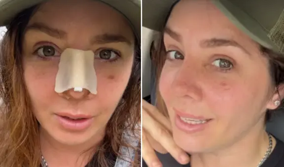 Yiddá Eslava comparte el resultado de su rinoplastia y explica por qué lo mantuvo en secreto: "Cambió mi vida"