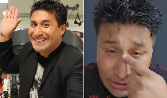 Danny Rosales postergó su operación de rinoplastia y explica que fue por "un problema personal"