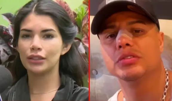 Samantha Batallanos lamenta que Jonathan Maicelo haya aceptado canje para una rinoplastia: “Voy a rezar”