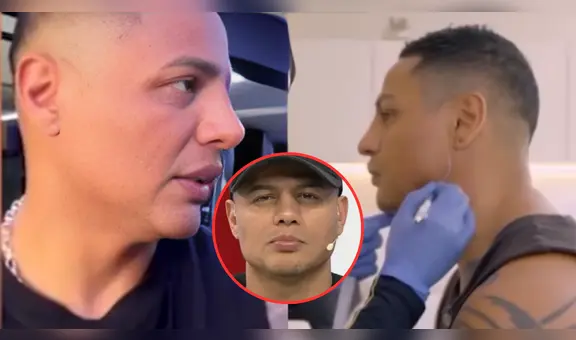 Jonathan Maicelo niega hacerse nuevos retoques estéticos, pero la Dra. Fit lo desmiente: "Le puse 15 jeringas"