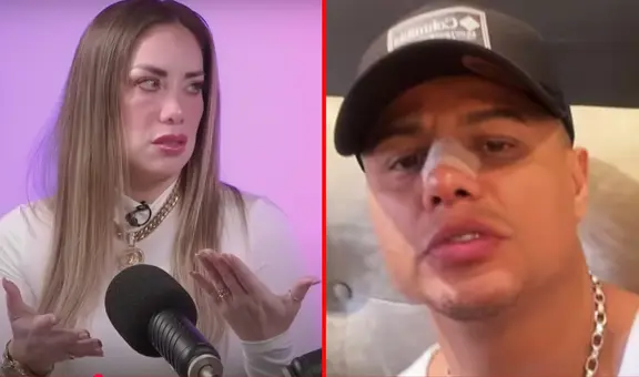 Grasse Becerra no apoya la rinoplastia que se hizo Jonathan Maicelo por canje: “No es bonito, nunca lo fue”