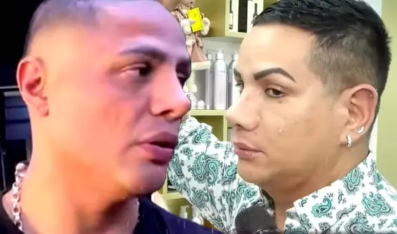 'Gemelo Paletazo' se pronuncia tras comparaciones por operación de Jonathan Maicelo: "Me dicen que tengo un trillizo"