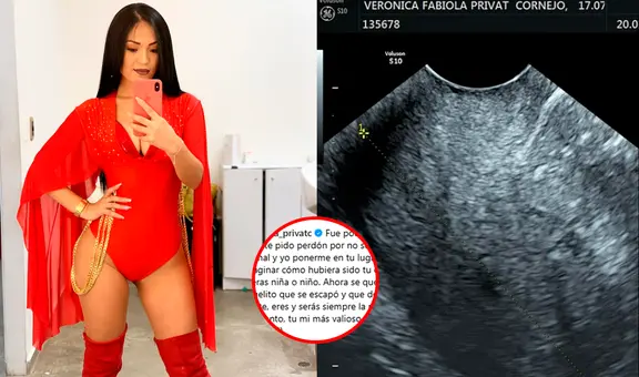 Verónica Privat, cantante de Alma Bella, anunció la pérdida de su bebé con emotiva publicación: “Te pido perdón”