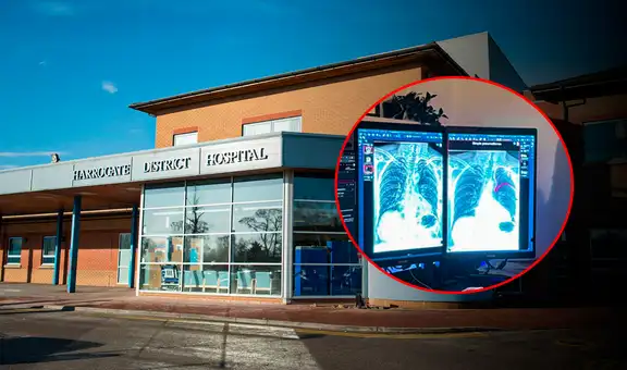 Hospital en Inglaterra usa IA para detectar cáncer y otras anomalías en segundos: hasta 124 hallazgos en menos de un minuto