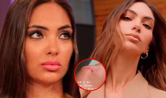 Natalie Vértiz sufre accidente durante la Semana de la Moda de Nueva York: "No todo es color de rosa"