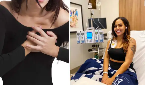 Mujer sintió dolor en el pecho y culpó a su sostén: descubrió que era cáncer de intestino y 20 tumores en el hígado
