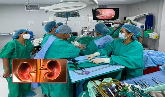 Essalud realiza con éxito el primer trasplante renal a un paciente con VIH: especialistas del Hospital Rebagliati han logrado un avance histórico