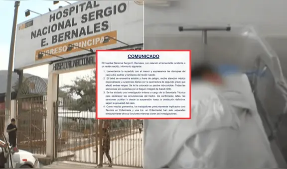 Hospital Sergio Bernales responde por bebé recién nacido que resultó quemado durante baño “Lamentamos lo sucedido”