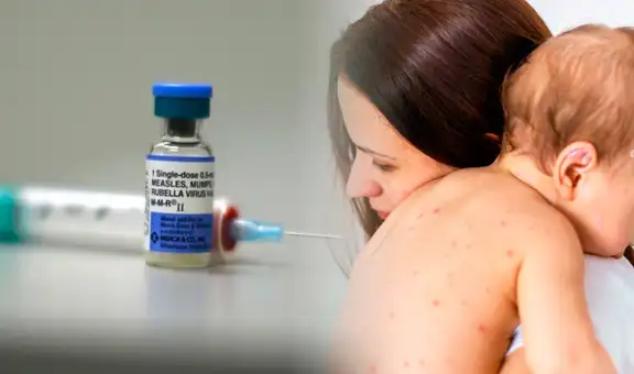 Aumentan casos de sarampión en Texas y en Nuevo México tras ser declarado "eliminado" en 2000: esto se sabe del brote en EE. UU.