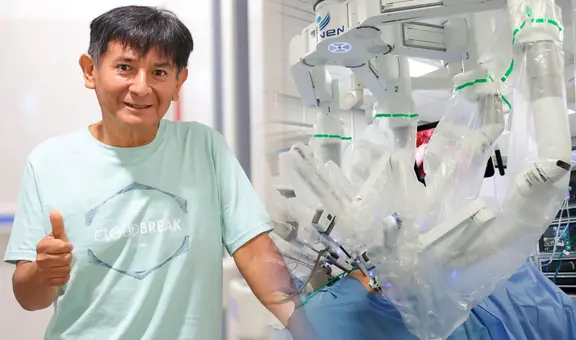 Robot opera a peruano con cáncer de estómago durante 7 horas y le salva la vida: "Me dio bastantes esperanzas"