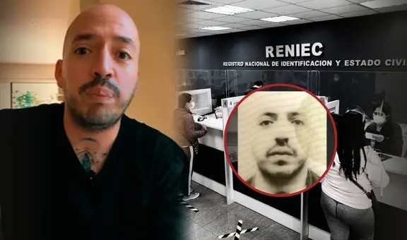 Peruano sufre inconveniente por su alopecia al renovar su DNI y tuvo que recibir ayuda: "Puede ser un caso de estudio"