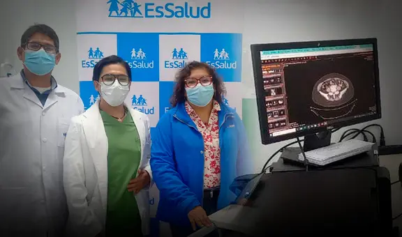 Proeza médica en Puno: doctores salvan la vida de adulto mayor tras extirparle tumor de 10 kilos
