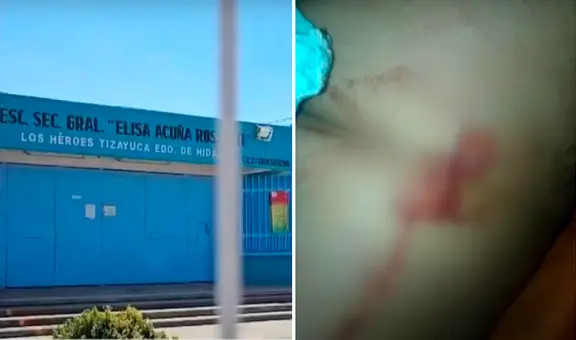Escolar es apuñalado tras defender a su compañera de acoso en México: padre del agresor lo atacó