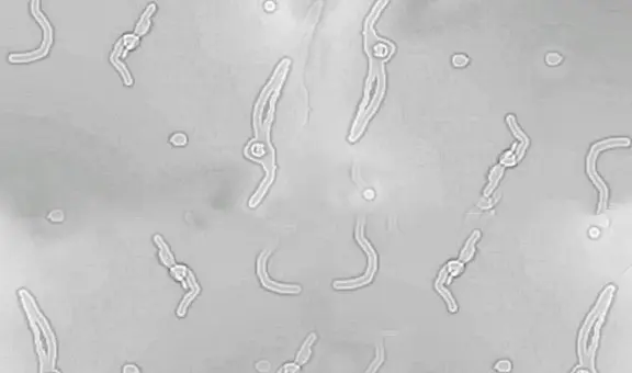 Esta es la razón por la que vemos 'gusanitos' o 'telarañas flotantes' en los ojos: ¿cómo controlarlas, según estudio?