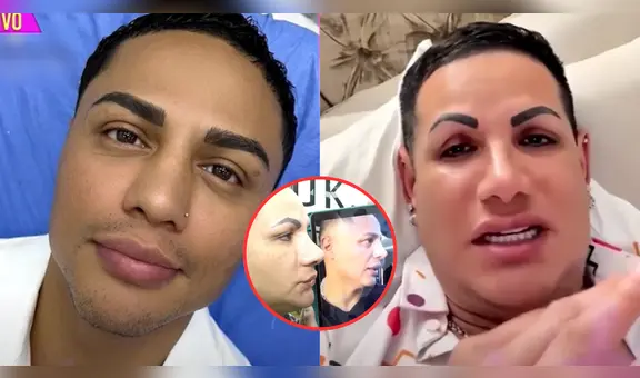 Jonathan Maicelo se somete a nuevos retoques en su rostro y sorprende a gemelo 'Paletazo': "¿Qué es eso, mi amor?"