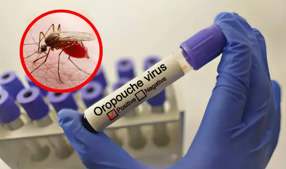 ¿Qué es el virus Oropouche, la nueva fiebre detectada en 5 casos diferentes por Minsalud en Venezuela?