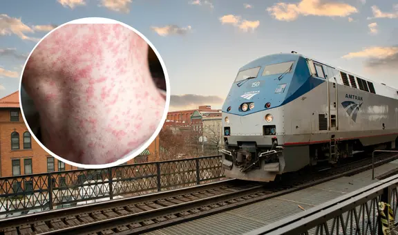Alerta en Nueva York: reportan que una persona infectada con el virus del sarampión viajó en el tren Amtrak