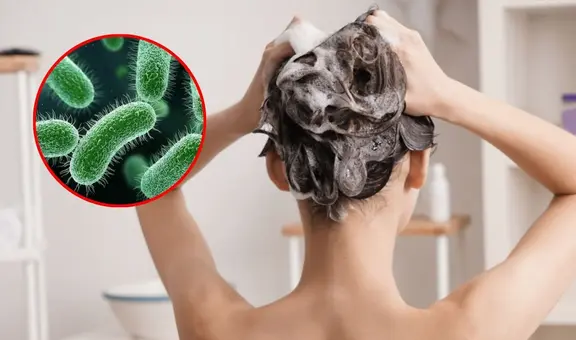 Alerta sanitaria en EEUU: retiran mil botellas de shampoo por posible contaminación bacteriana