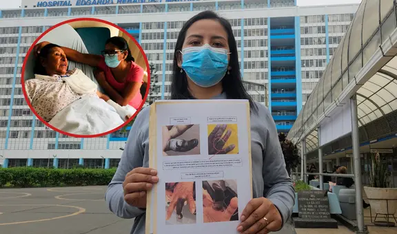 "Mi madre entró por una fractura y terminó sin un dedo": denuncian presunta negligencia médica en hospital Rebagliati