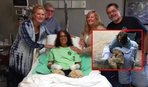 Despertó de un coma y descubrió que perdió sus manos y piernas por besar a su perro: conoce la historia de Marie Trainer