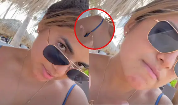 Susana Alvarado sufre inesperada reacción en su piel en su viaje con Paco Bazán al Caribe: "Todo mal"