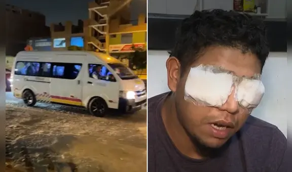 Chofer de 'La Colonial' podría quedar ciego tras ser baleado por extorsionadores que exigían el pago de cinco soles diarios