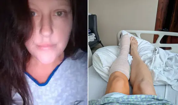 Mujer estuvo al borde de la muerte por una uña encarnada: terminó con medio pie amputado tras una sepsis letal