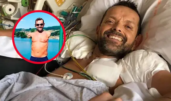 Hombre que perdió los brazos tras descarga eléctrica recibe un trasplante histórico después de 23 años