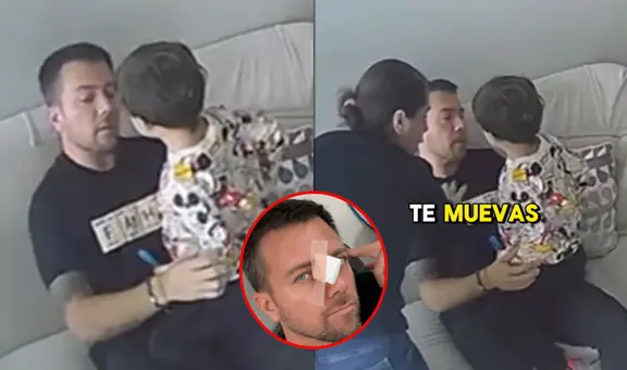 Julián Zucchi muestra el preciso momento de su accidente en casa de Yiddá Eslava y la reacción de la actriz: "Una cicatriz más"