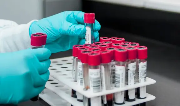 Escándalo en Reino Unido: 400.000 personas expuestas a hepatitis por transfusiones de sangre contaminada