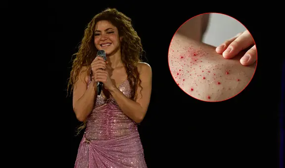 Nueva Jersey lanza alerta sanitaria tras un posible contagio masivo de sarampión en concierto de Shakira