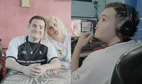 Superó leucemia, una infección que afecto su cara y 30 cirugías: la historia de superación de un adolescente que estuvo al borde de la muerte en Argentina