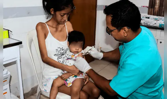 Tos ferina causa la muerte de 15 infantes en Loreto, pero el Gobierno redujo presupuesto para vacunación en 2025