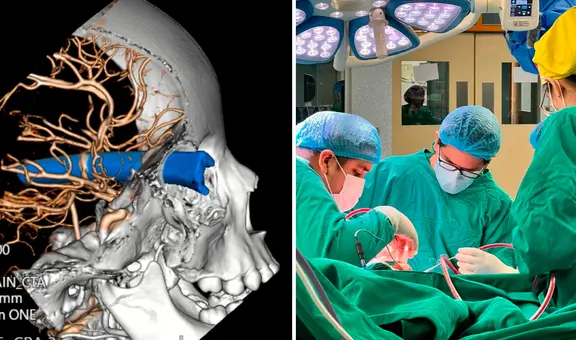 Salvan de morir a niño de 3 años que quedó con un metal incrustado en su cabeza, en San Borja