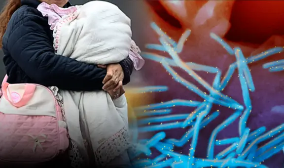 Más de 400 recién nacidos mueren al año por virus sincitial respiratorio y Minsa no aplica vacuna