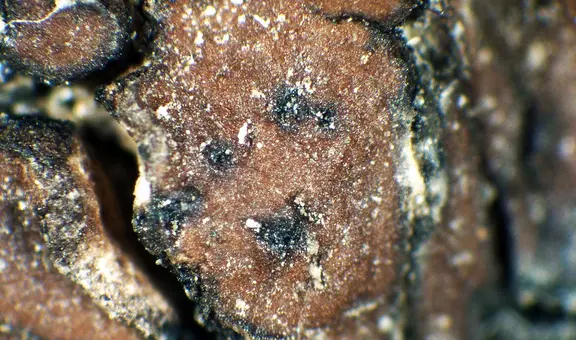 Ni un bombardeo de radiación es capaz de destruir a esta forma de vida tan resistente