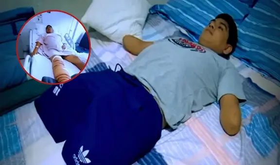 Peruano fue por una operación de rodilla y termina con las 4 extremidades amputadas: habría adquirido una bactería en clínica de La Molina