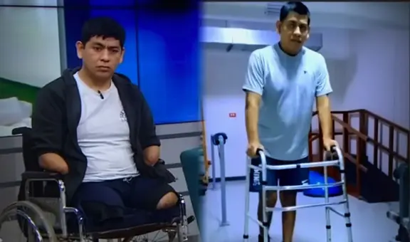 Peruano fue por una operación de rodilla y termina con las 4 extremidades amputadas: habría adquirido una bacteria en clínica de La Molina