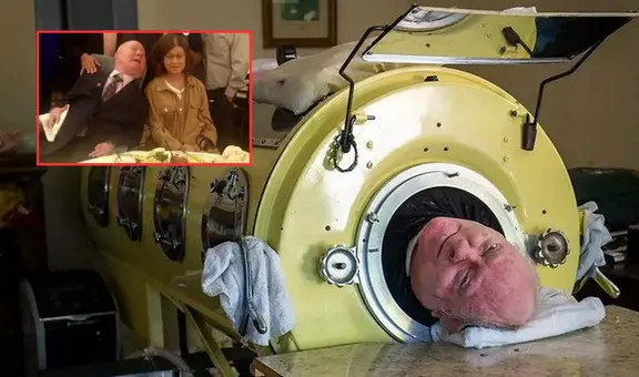 El increíble caso de Paul Alexander, el hombre que vivió con un pulmón de acero más de 70 años por padecer polio