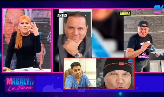 Mauricio Diez Canseco reaparece con radical cambio de rostro, pero cirujanos advierten: “No se lo hubiera realizado”